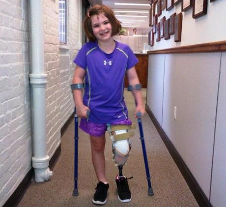 Jane Richard, who lost her older brother Martin and her left leg in the Boston Marathon bombing, is recovering and using a prosthetic. 

