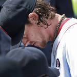 Clay Buchholz exited the game in the third inning on Monday. 