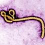 In this handout from the Center for Disease Control (CDC), a colorized transmission electron micrograph (TEM) of a Ebola virus virion is seen.