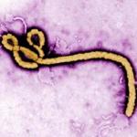 In this handout from the Center for Disease Control (CDC), a colorized transmission electron micrograph (TEM) of a Ebola virus virion is seen.