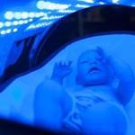 A baby mannequin is bathed in blue LED lights in a Bili-Hut prototype, in Boston.