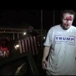 This still image taken from video shows a supporter of Republican presidential candidate Donald Trump after a protest on Thursday, April 28, 2016 in Costa Mesa, Calif. Dozens of protesters were mostly peaceful Thursday as Trump gave his speech inside the Pacific Amphitheater. After the event, however, the demonstration grew rowdy late in the evening and spilled into the streets. (APTN via AP Photo)