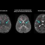 Doctors say MRIs of children?s brains are easily misread.