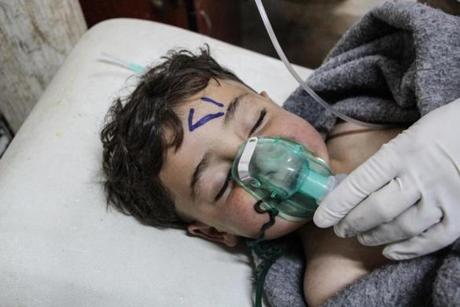 A Syrian child received treatment after an alleged chemical attack at a field hospital in northern Syria Tuesday.  
