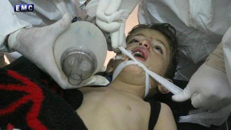 A child received treatment at a field hospital after a chemical attack in Syria. 
