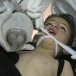 A child received treatment at a field hospital after a chemical attack in Syria. 
