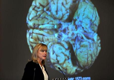 Dr. Ann McKee announced her findings on her examination of the brain of Aaron Hernandez.
