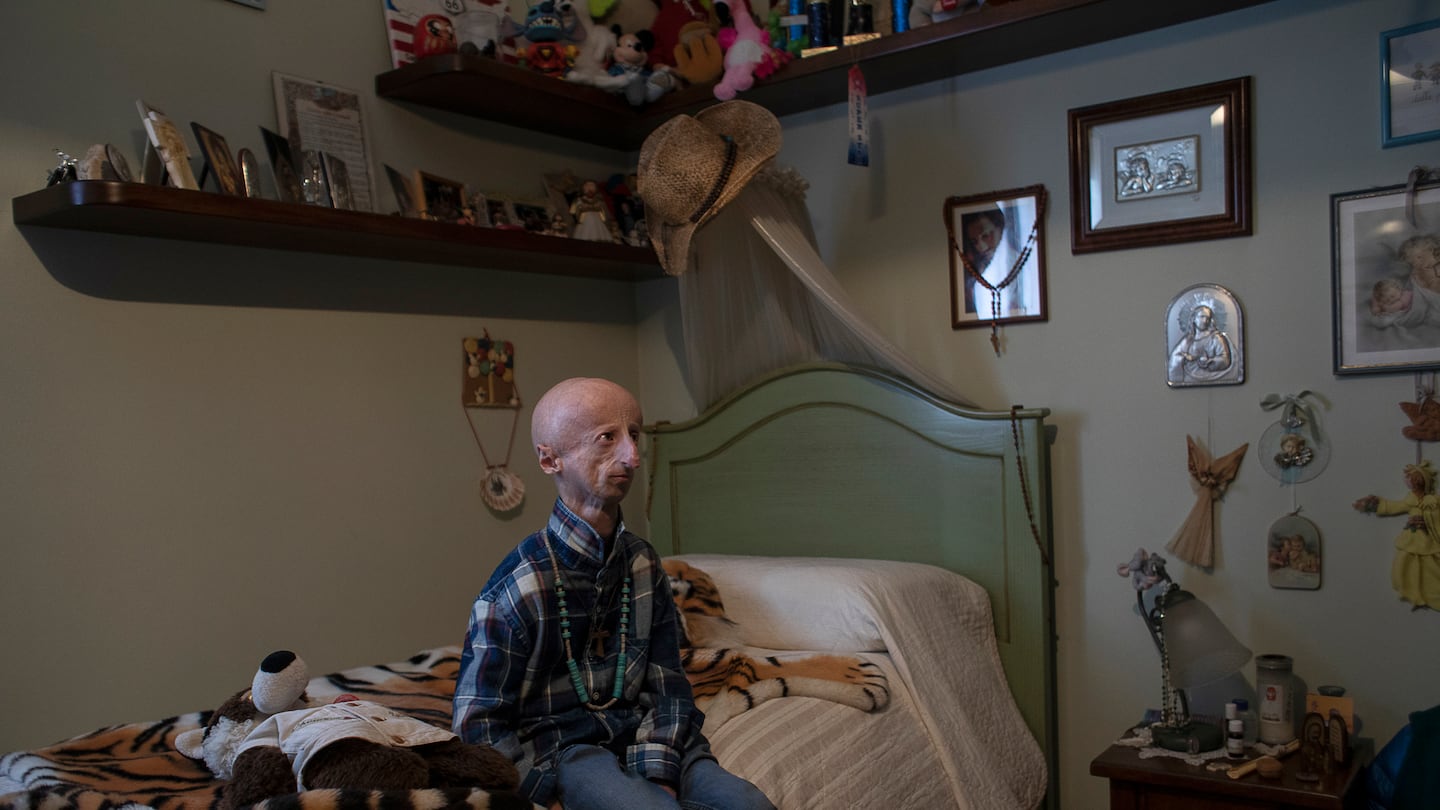 Basso, who was born with progeria, at home in Bassano del Grappa, Italy, in 2022.