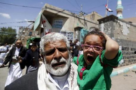 A man carried a girl out of a mosque that was attacked by a suicide bomber in Sanaa, Yemen on Friday.
