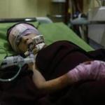 A child received medical treatment at a hospital on Monday after being injured in shelling in Douma, Syria. Meanwhile, military operations took a brief pause in the northern part of the country for fixes to a dam held by the Islamic State.