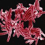 Mycobacterium tuberculosis kills 1.5 million people yearly.