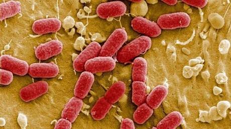 Enterohemorrhagic E. coli, EHEC for short, comprises strains of bacteria that disrupt the GI tract and cause bleeding.
