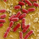 Enterohemorrhagic E. coli, EHEC for short, comprises strains of bacteria that disrupt the GI tract and cause bleeding.