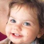 1-year-old Remmy was attacked by a Pit Bull in her home in Falmouth Sunday.  