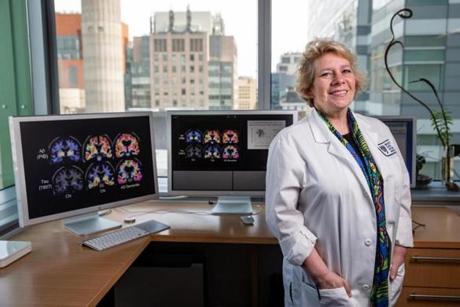 05/16/2018 BOSTON, MA Dr. Reisa Sperling (cq) poses for photos in her office with PET scans on her computer at Brigham and Women's Hospital in Boston. (Aram Boghosian for The Boston Globe)
