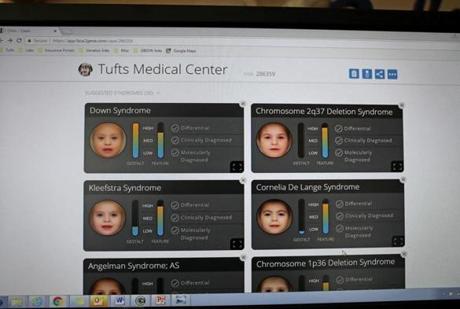 Dr. Dallas Reed, an obstetrician-gynecologist and medical geneticist, uses a new software program to help diagnose kids with rare genetic diseases. 
