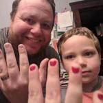 Aaron Gouveia and his 5-year-old son, Sam, show off their nails after Sam was bullied at school.