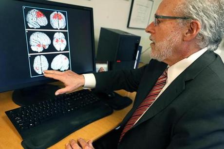 EMBARGOED UNTIL 5:00PM, 04/10/2019Boston, MA., 04/10/2019, Dr. Robert Stern, neurology professor at the BU School of Medicine and leader of the CTE study with images of brains with evidence of CTE. Suzanne Kreiter/Globe Staff
